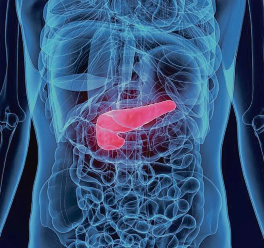 Cáncer de Páncreas