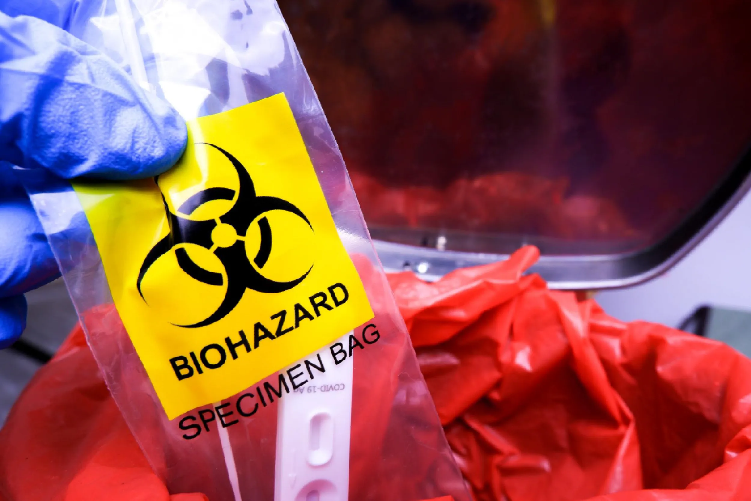 OMS declara emergencia internacional por brote de ébola en África.